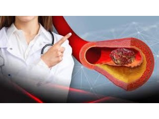 Аценокумарол: Профілактика тромбозу і лікування серцевих ускладнень